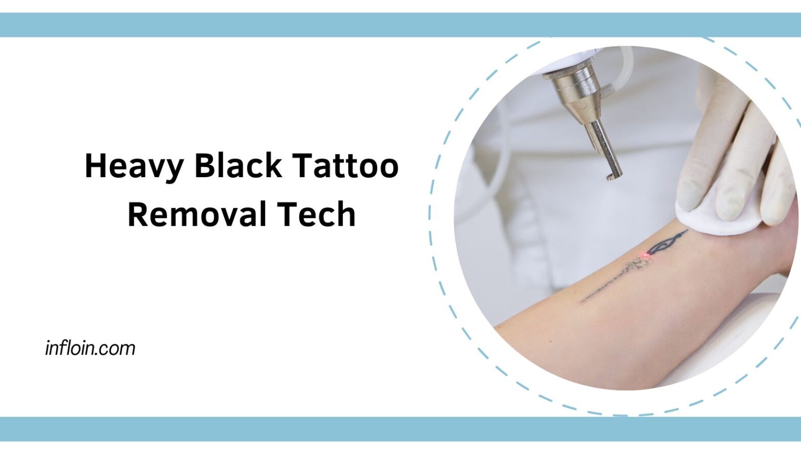 Heavy Black Tattoo Removal